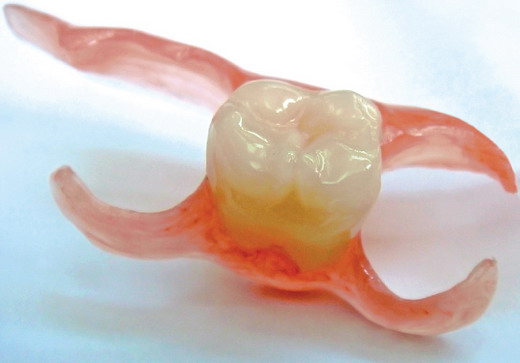 Современные зубные протезы съемного типа